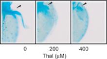 thalidomide treatment
