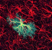 Astrocyte image