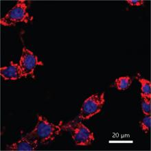Fluorescence image of breast cancer cells incubated with dye-loaded BSA nanoparticles