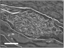 Abnormal membrane structure observed in the outermost skin layer of a mouse lacking FATP4. Scale: 1µn. 
