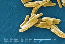tuberculosis seen under SEM