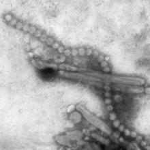 Electron micrograph of Influenza A H7N9