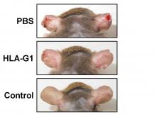 Mice treated with HLA-G1 showed marked improvement of the skin lesions compared to PBS (saline) treated mice. Control mice with no induced atopic dermatitis is shown as control. (Maeda N., et al., International Immunopharmacology, July 1, 2017)