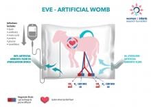 Artificial womb raises hope for premature babies