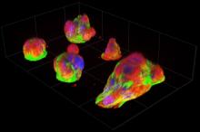 Fluorescence images of pancreatic cancer micro-tumors
