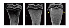 Rat tibia micro CT scan comparison