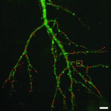 Neuron Imaging