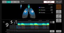 Continuous respiratory sound monitoring device-Respiratory failure prediction