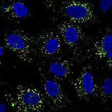 Dengue-infected cells taken under a microscope 