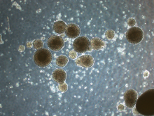 Human brain cancer cells forming spherical structures on the DN gel