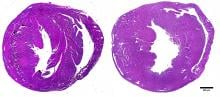 Cross-section of the heart