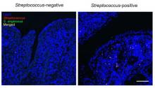Detection of oral bacteria in gastric cancer tissue. 