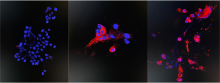 Immunofluorescence staining of uninfected and infected Vero E6 cells