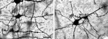 When mice that exhibit SLE-like symptoms are subjected to sleep deprivation stress, their neurons exhibit abnormal growth (left). When IL12 and 23 are blocked, the abnormal growth is reversed (right; Nobuya Abe, et al. Annals of the Rheumatic Diseases. July 11, 2022).