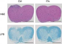 In mice models with adoptive transfer experimental autoimmune encephalomyelitis, treatment with itaconate (right) greatly ameliorates the effects of the disease, compared to untreated mice (Kuniyuki Aso, et al. Nature Communications. February 27, 2023).