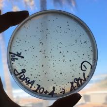 Microbial cultures used in the study to investigate the biosynthesis of actinopyradizone (Photo: Kenichi Matsuda).