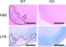 The inflammatory reaction in spinal cords of STAP-1 knockout (KO) mice was less severe than that of wild type (WT) mice (top panels). In parallel, spinal cords of STAP-1 KO mice exhibited less demyelination—loss of the myelin sheath that surrounds nerves—when compared with those of WT mice (bottom panels). (Kota Kagohashi, et al. The Journal of Immunology. February 5, 2024)