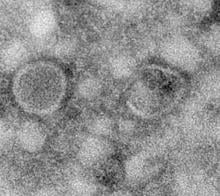 Electron microscopy image of extracellular vesicles secreted by muscles