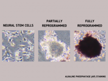 alkaline phosphatase staining to track cell reprogramming
