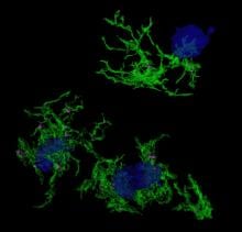 Plaque-eating microglia