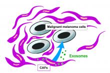 Exosomes from cancer-associated fibroblasts may suppress malignant melanoma