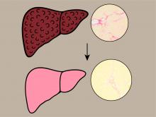 Lawsone, a component of henna, restores liver health by inhibiting fibrosis