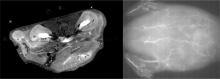 The scientists injected the nanoparticle solution into the tail veins of live mice and were able to obtain high quality MRI (left) and near-infrared fluorescence (right) scans of tissues and blood vessels. 
