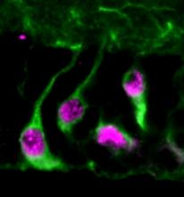 When quiescent neural stem cells in the fruit fly larval brain are activated, they can generate new neurons. In the image, the nucleus of quiescent neural stem cells is labelled by a marker of neural stem cells named Deadpan in magenta, and the cell outline is marked in green.