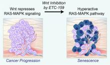 When researchers inhibited Wnt signalling the anti-cancer drug ETC-159, they found that the reactivation of the hyperactive RAS-MAPK pathway led the cancer cells to undergo senescence, which is an ageing process that results in arrested growth.