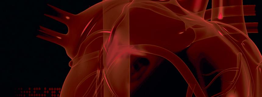 3D heart