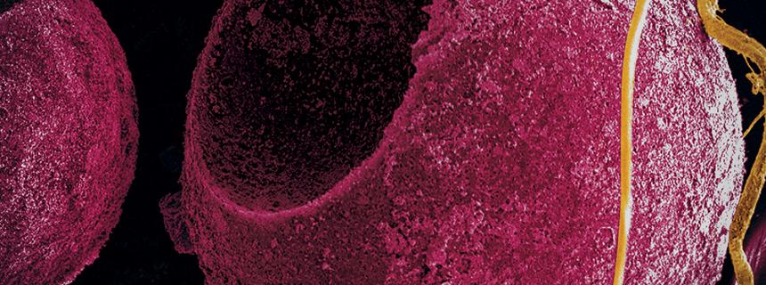 Quantum dots made of cadmium sulfide emit ultraviolet and blue wavelengths of light. Toxicity remains a concern for biological applications.