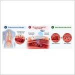 New smart patch could help detect and treat blood clots