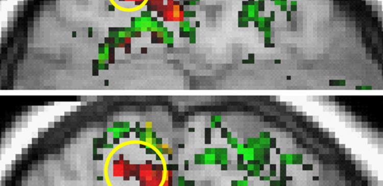 brain activity fMRI