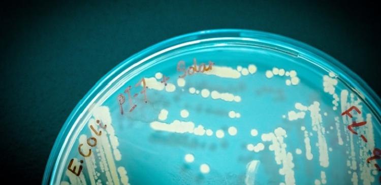 Bacteria growing on an agar plate. 