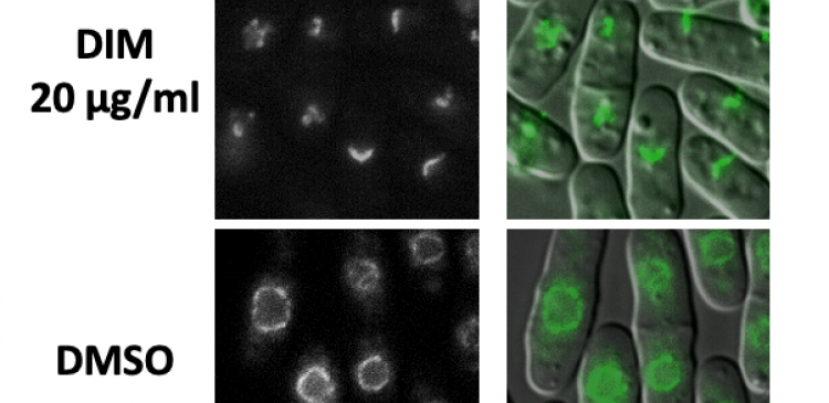 DIM damages nuclear membrane in fission yeast 