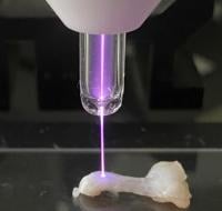 The Achilles tendon of a rat is irradiated with non-thermal atmospheric-pressure plasma.