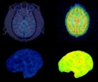 9Sep-Brain1