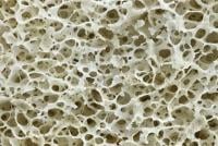 bone cross section