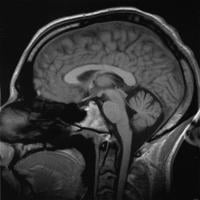 30Sep-Brain1