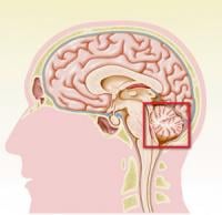 7Oct-Brain1