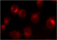 cancer cells