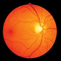 healthy eye