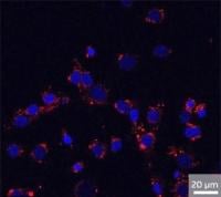 Cancer cells