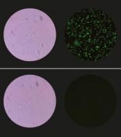 GFP bacteria