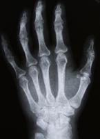 bones