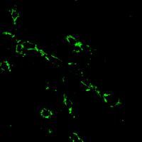A new fluorescent glucose-amine probe
