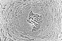 Bone tissue
