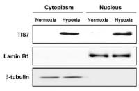 Cytoplasm