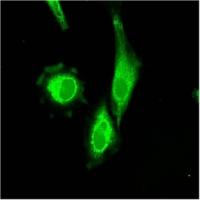 Cancer cell image