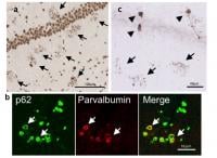 Degenerating interneurons in frontotemporal lobar degeneration (FTLD) mice